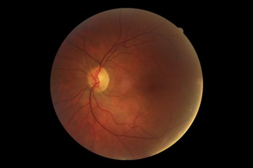 Wehrle_ID#WehrleKat-441MP2_aazny